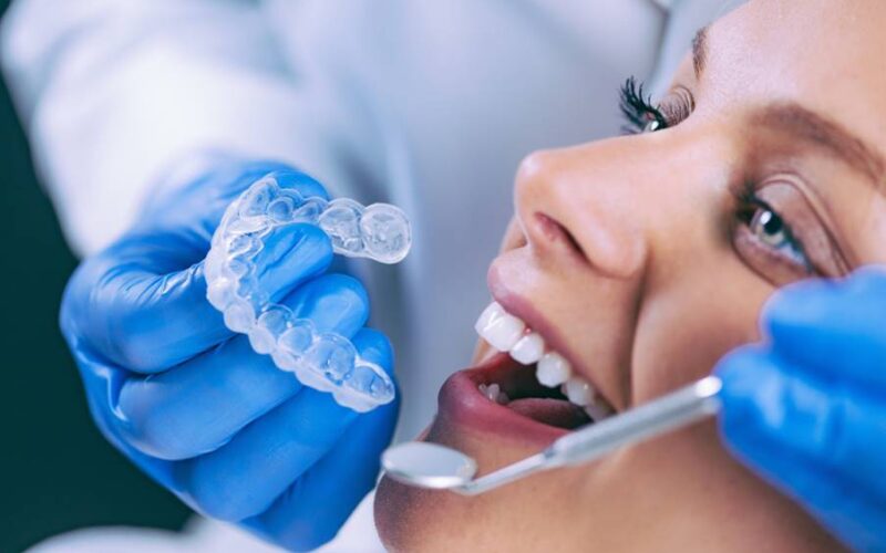 Step by Step Insights into the Invisalign Treatment Process