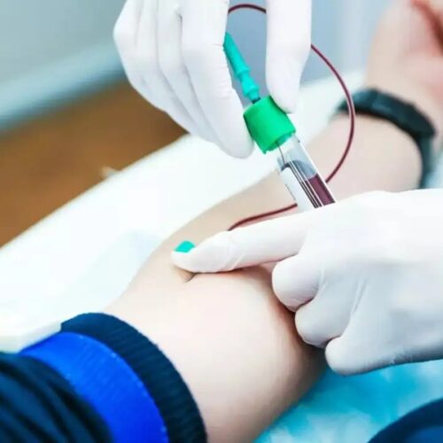 Health Screening Red Flags That Should Prompt Earlier Testing