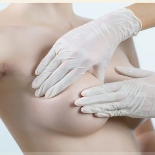 Premium Augmentation Mammoplasty Services, Supporting Refined Silhouette Improvement with Advanced Surgical Techniques